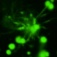 Microscopic view of Alzheimer's-related fibrils. 