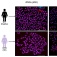 Slides from a Huntington's disease study comparing healthy human neurons with neurons of a Huntington’s disease patient where GSK3ß and ERK1 were upregulated. . 