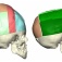 Skulls before and after reduction surgery. 